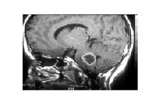 Servicios de Neurocirugía: Especialidades y publicaciones de Doctor Villarejo Servicios de Neurocirugía: Especialidades y publicaciones de Doctor Villarejo