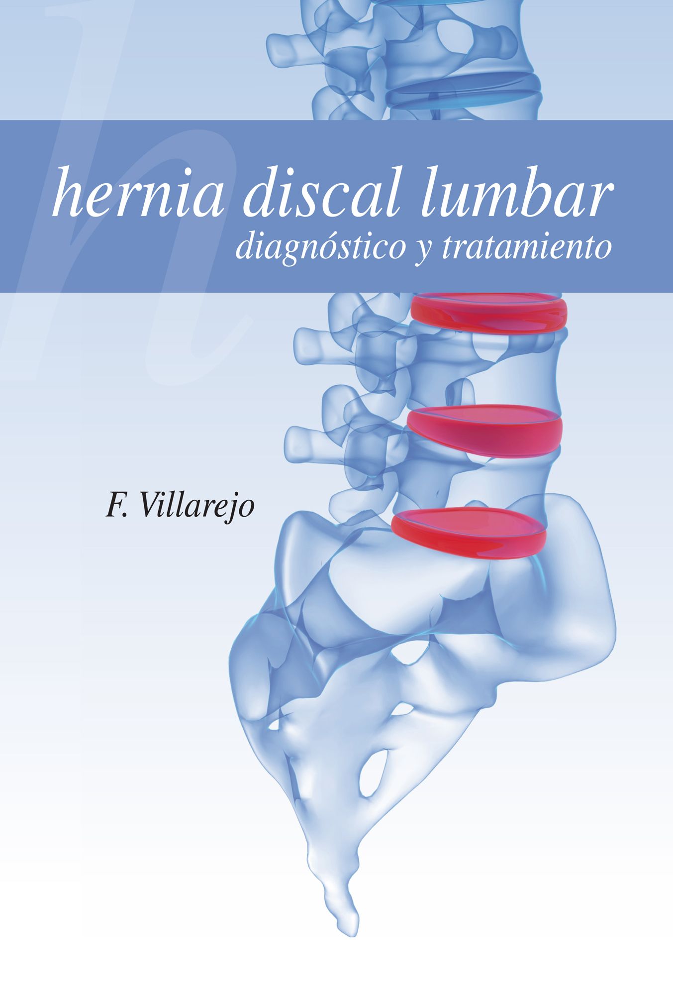 Hernia discal lumbar diagnóstico y tratamiento Especialidades y