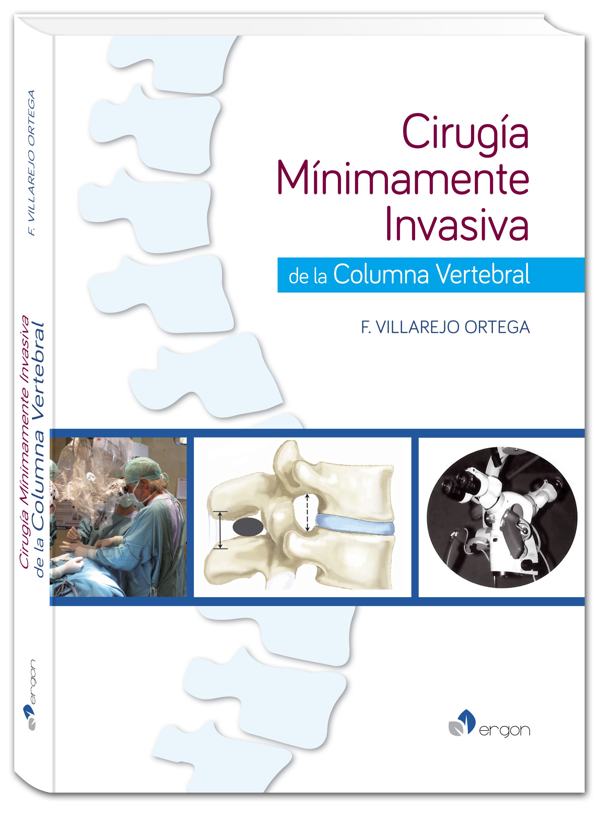 Cirugía Minímamente Invasiva de la Columna Vertebral: Especialidades y publicaciones de Doctor Villarejo Cirugía Minímamente Invasiva de la Columna Vertebral: Especialidades y publicaciones de Doctor Villarejo