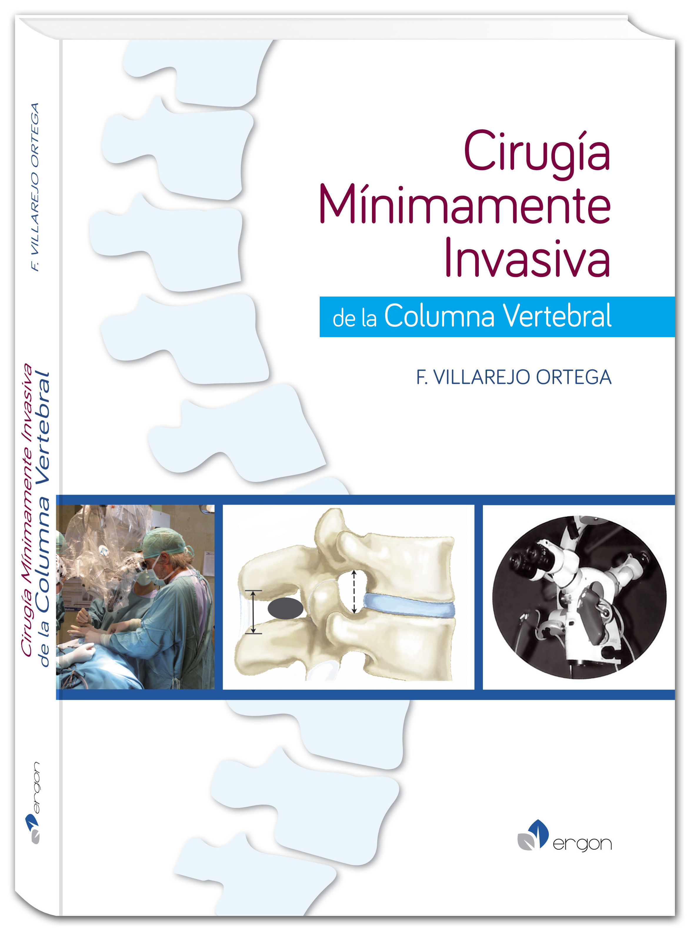CIRUGÍA MÍNIMAMENTE INVASIVA DE LA COLUMNA VERTEBRAL F. VILLAREJO ORTEGA CIRUGÍA MÍNIMAMENTE INVASIVA DE LA COLUMNA VERTEBRAL F. VILLAREJO ORTEGA