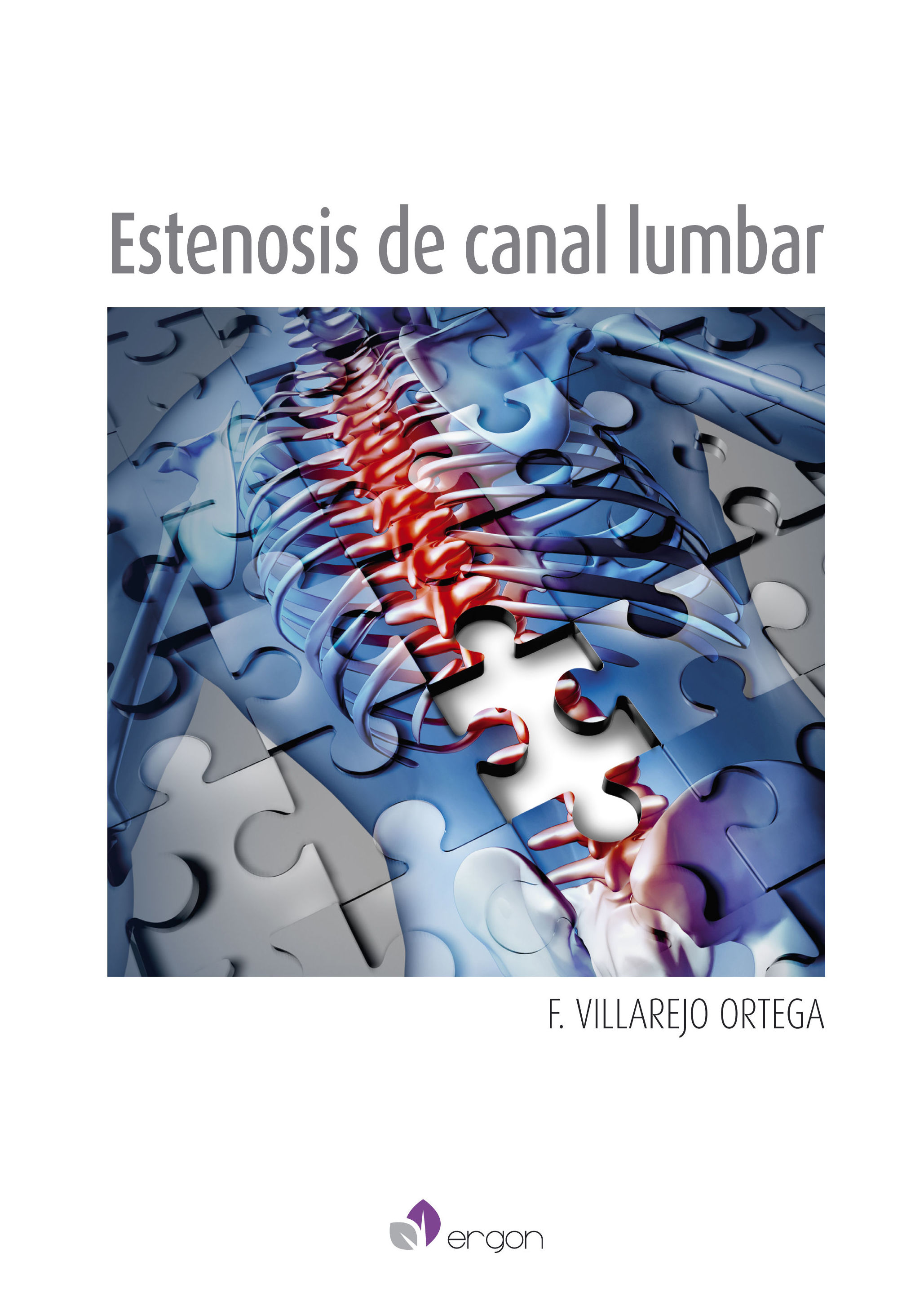 ESTENOSIS DEL CANAL LUMBAR F. VILLAREJO ORTEGA ESTENOSIS DEL CANAL LUMBAR F. VILLAREJO ORTEGA