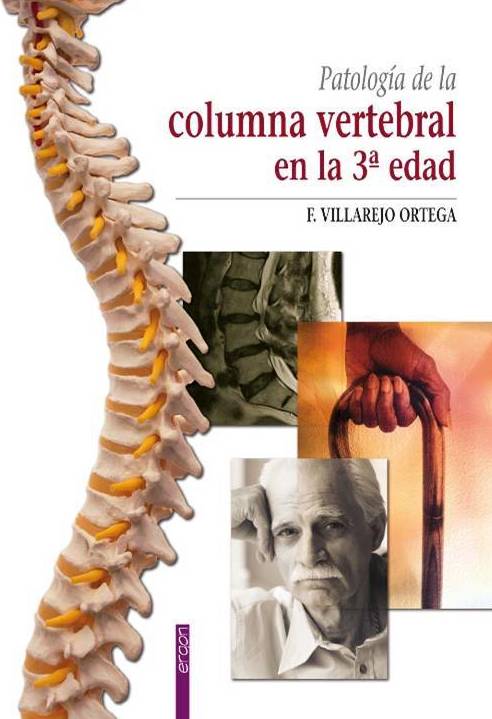 PATOLOGÍA DE LA COLUMNA VERTEBRAL EN LA TERCERA EDAD F. VILLAREJO ORTEGA PATOLOGÍA DE LA COLUMNA VERTEBRAL EN LA TERCERA EDAD F. VILLAREJO ORTEGA