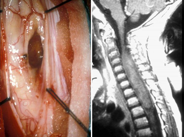 Patología raquimedular: Especialidades y publicaciones de Doctor Villarejo Patología raquimedular: Especialidades y publicaciones de Doctor Villarejo