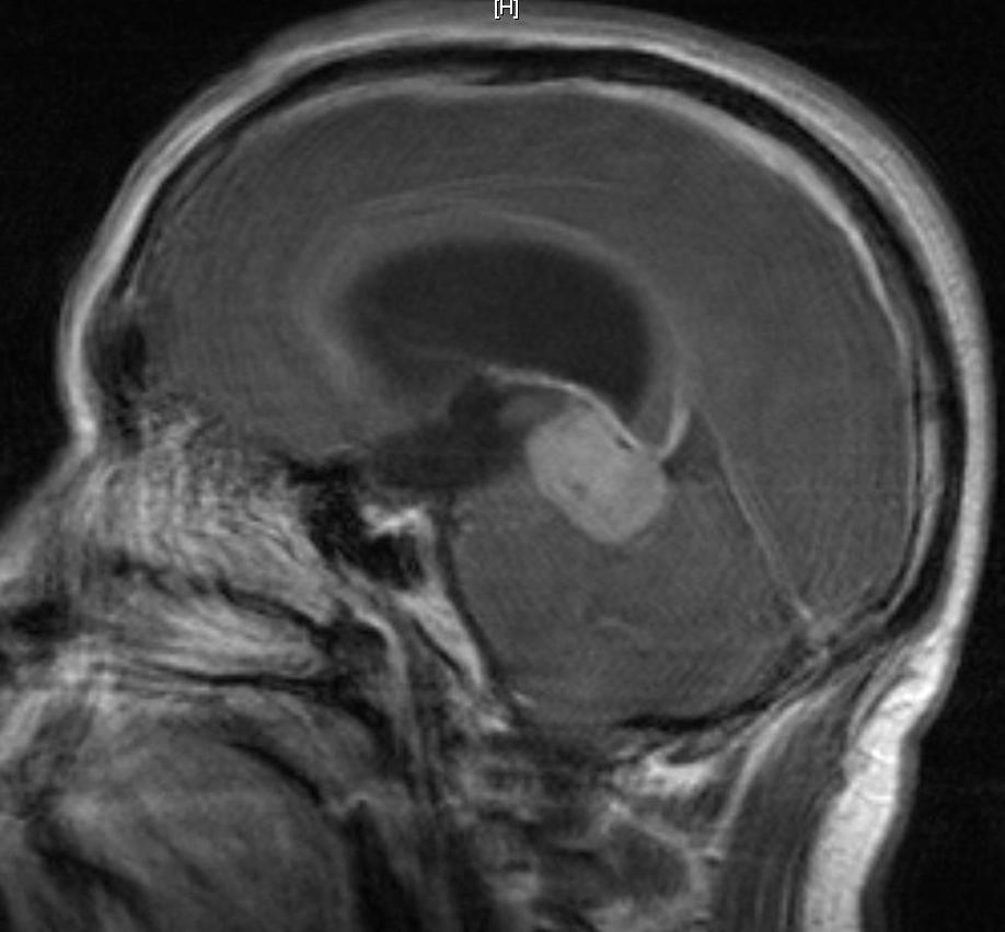 Patología craneoencefálica: Especialidades y publicaciones de Doctor Villarejo Patología craneoencefálica: Especialidades y publicaciones de Doctor Villarejo