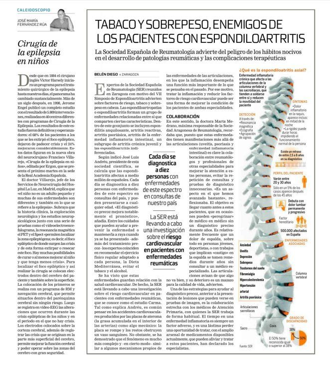 Artículo periódico Tribuna: Cirugía de la epilepsia en niños: Especialidades y publicaciones de Doctor Villarejo Artículo periódico Tribuna: Cirugía de la epilepsia en niños: Especialidades y publicaciones de Doctor Villarejo