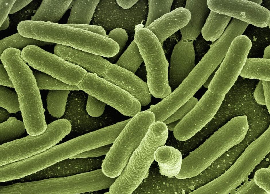 Legionella: Servicios de Dys - Hy Legionella: Servicios de Dys - Hy