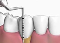 Periodoncia: Tratamientos de Clínica Dental Tucán Periodoncia: Tratamientos de Clínica Dental Tucán