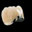 Corona metal porcelana: Tratamientos de Clínica Dental Tucán Corona metal porcelana: Tratamientos de Clínica Dental Tucán