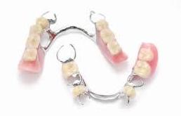 Prótesis removible: Tratamientos de Clínica Dental Tucán Prótesis removible: Tratamientos de Clínica Dental Tucán