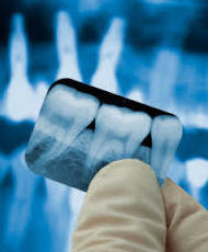 Rx dental: Tratamientos de Clínica Dental Tucán Rx dental: Tratamientos de Clínica Dental Tucán