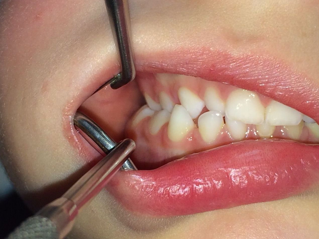 Odontología Pediátrica: Tratamientos de Clínica Dental Tucán Odontología Pediátrica: Tratamientos de Clínica Dental Tucán