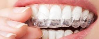 Prótesis removible: Tratamientos de Clínica Dental Tucán Prótesis removible: Tratamientos de Clínica Dental Tucán