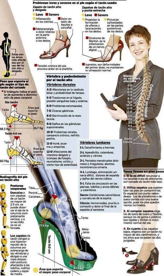 Problemas según el tacón que usamos Problemas según el tacón que usamos