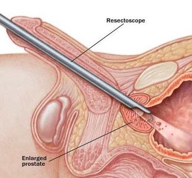 Diagnóstico y tratamientos en urología y andrología