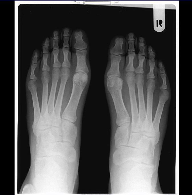 Servicio de radiografía del pie