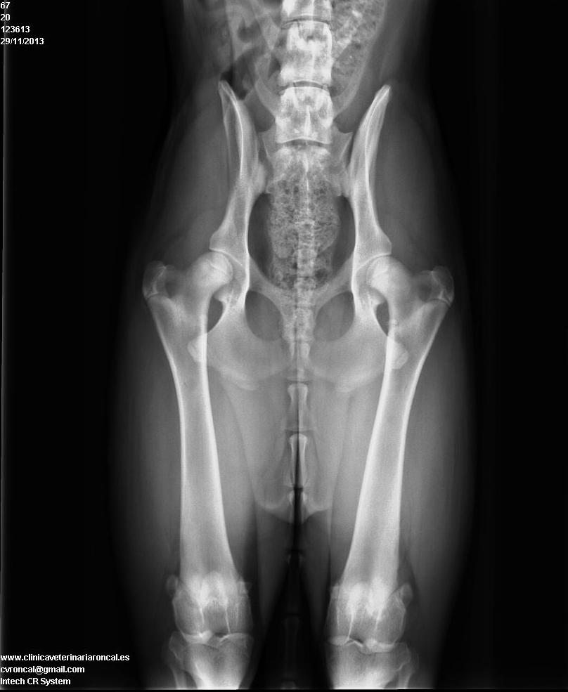 Radiografia de caderas Radiografia de caderas