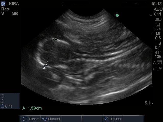 Ecografía abdominal y cardíaca Ecografía abdominal y cardíaca
