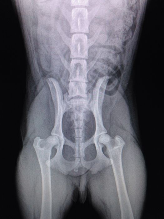 Radiología digital Radiología digital