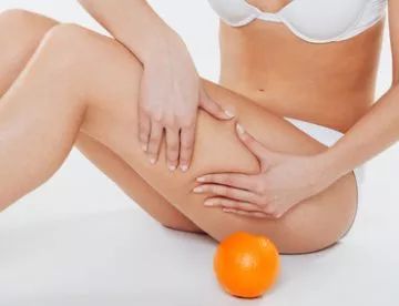 Tratamiento de la celulitis: Tratamientos de Medicina Estética Profesional Tratamiento de la celulitis: Tratamientos de Medicina Estética Profesional