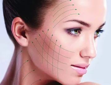 Tipos de hilos en medicina estética: Tratamientos de Medicina Estética Profesional Tipos de hilos en medicina estética: Tratamientos de Medicina Estética Profesional