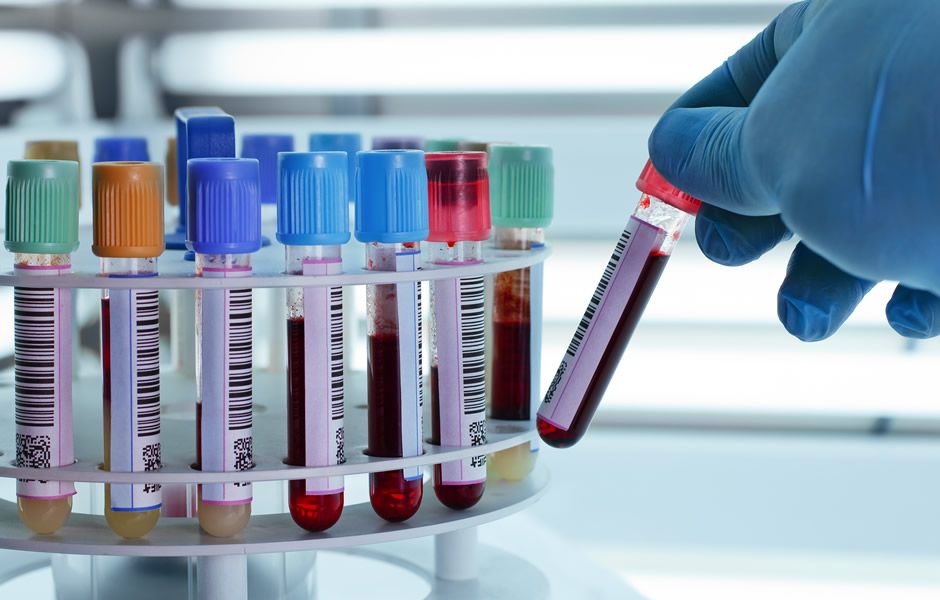 Técnicas en sangre Técnicas en sangre