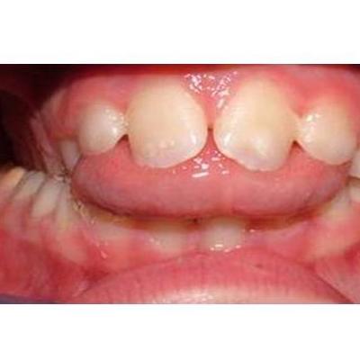 Trastornos funcionales dentofaciales: Servicios de Clínica Foniatría - Logopedia Doctora Fernández Salazar