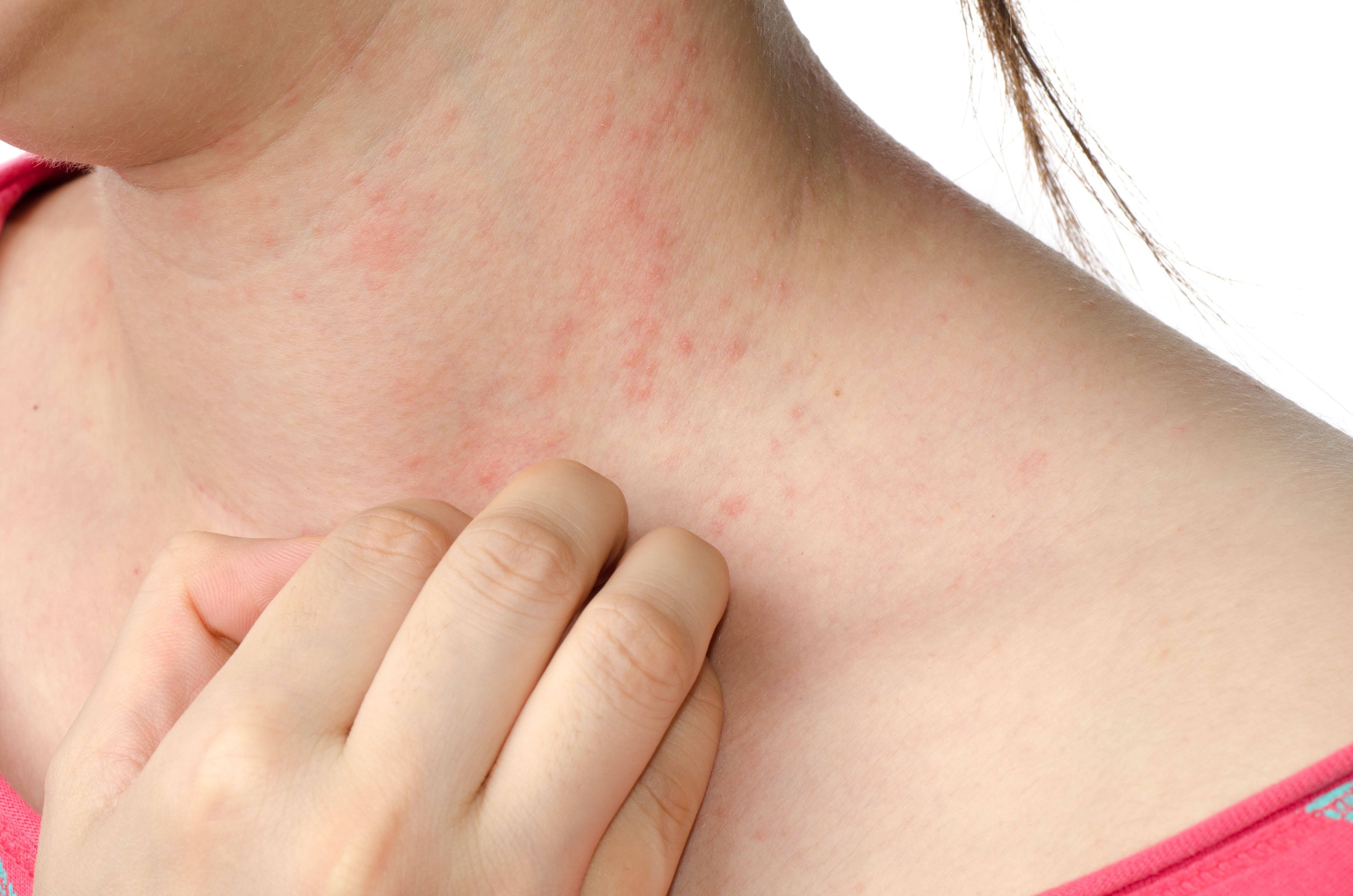 Dermatología: Servicios de Farmacia Latasa Barros Dermatología: Servicios de Farmacia Latasa Barros