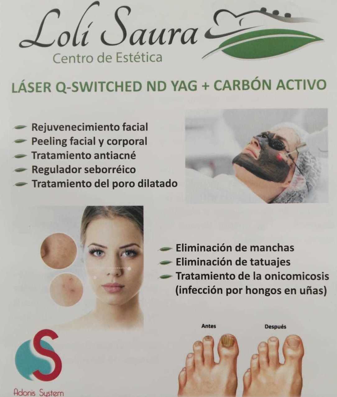 Láser Q- Switched ND Yag + Carbón Activo : Servicios de Estética Loli Saura Láser Q- Switched ND Yag + Carbón Activo : Servicios de Estética Loli Saura