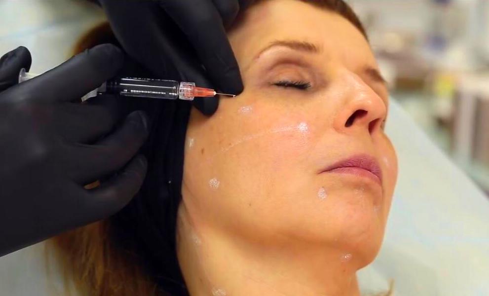 Toxina Botulínica: Servicios de Estética de Medicina & Estética Glamour Toxina Botulínica: Servicios de Estética de Medicina & Estética Glamour