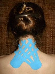 Vendaje neuromuscular: Servicios de Fisio+ Vendaje neuromuscular: Servicios de Fisio+