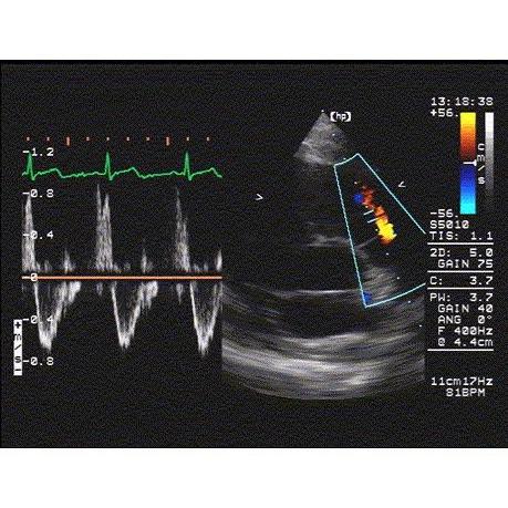 Electrocardiografía: Servicios de Clínica Veterinaria Besaya Electrocardiografía: Servicios de Clínica Veterinaria Besaya