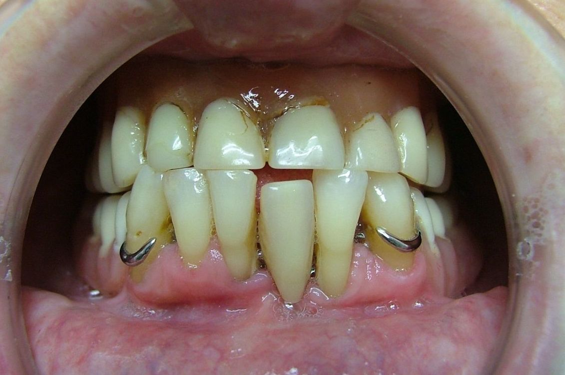 Foto 30 de Clínicas dentales en O Milladoiro | Clínica Implanteoral Milladoiro