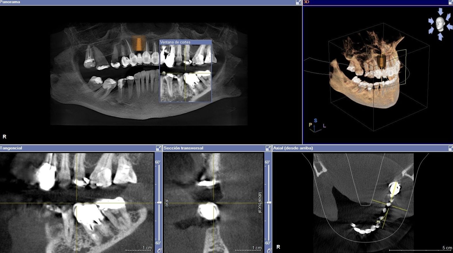 radiología digital 3 D en MILLADOIRO radiología digital 3 D en MILLADOIRO