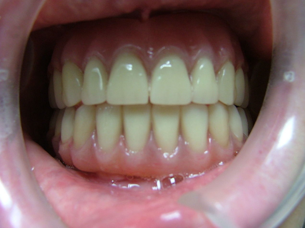 Foto 17 de Clínicas dentales en O Milladoiro | Clínica Implanteoral Milladoiro