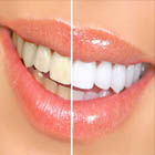 Estética dental: Servicios de Clínica Implanteoral Milladoiro Estética dental: Servicios de Clínica Implanteoral Milladoiro