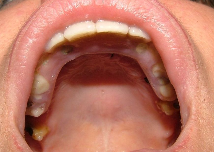 Foto 39 de Clínicas dentales en O Milladoiro | Clínica Implanteoral Milladoiro