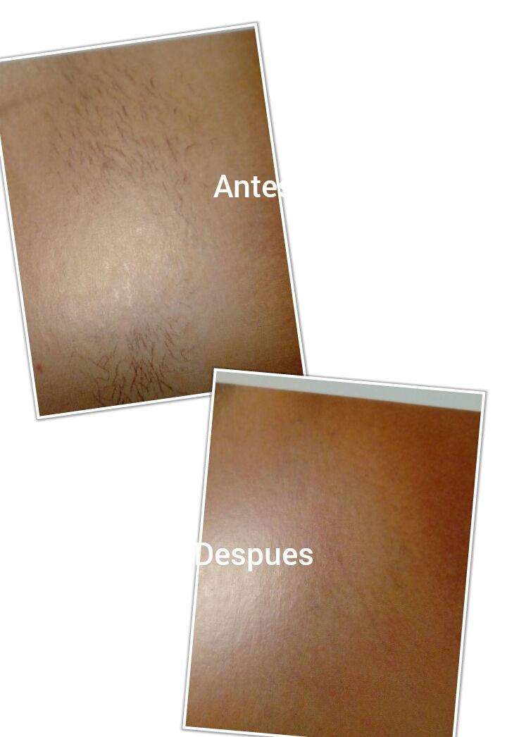 Depilación con Sorisa: Servicios de Salón de Belleza Sukaro Depilación con Sorisa: Servicios de Salón de Belleza Sukaro