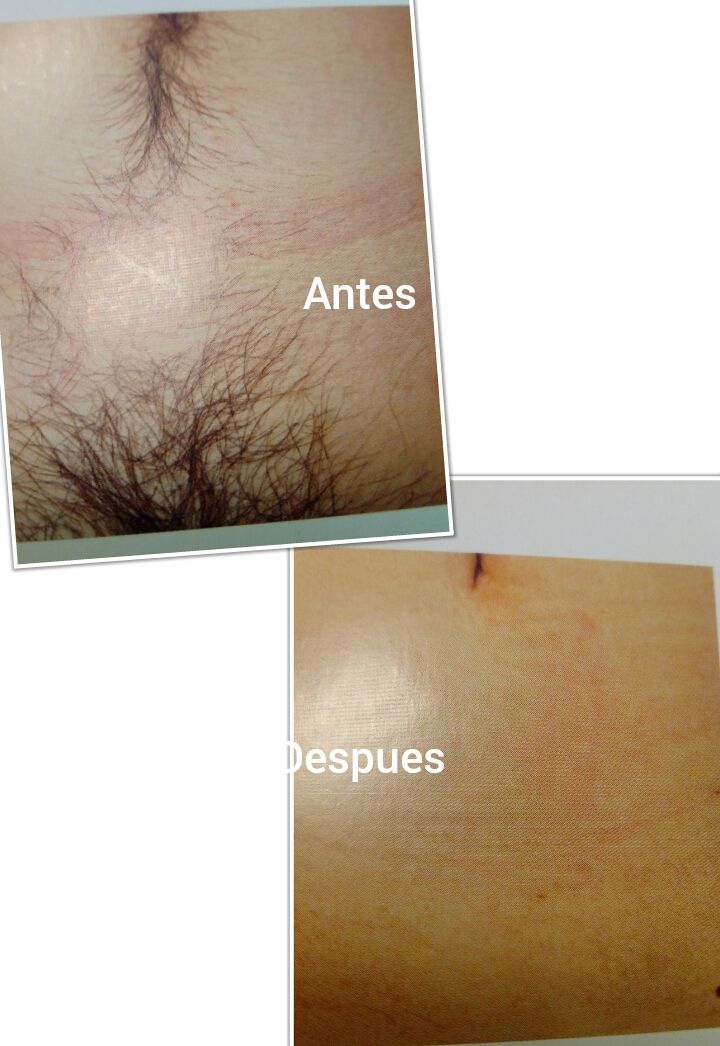 Depilación con Sorisa: Servicios de Salón de Belleza Sukaro Depilación con Sorisa: Servicios de Salón de Belleza Sukaro