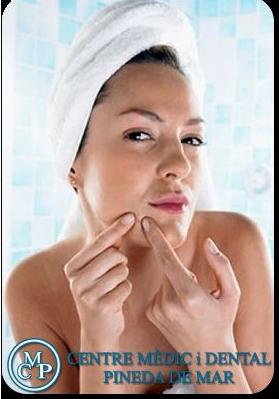 Tratamientos antiacne en Pineda de Mar Tratamientos antiacne en Pineda de Mar