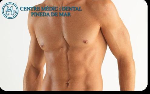 GINECOMASTIA: Tratamientos de Centro Médico y Dental Pineda GINECOMASTIA: Tratamientos de Centro Médico y Dental Pineda