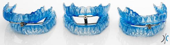 orthoapnea orthoapnea