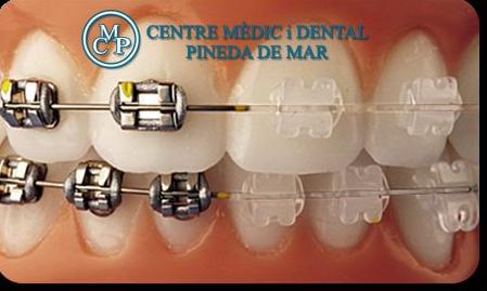 ORTODONCIA: Tratamientos de Centro Médico y Dental Pineda ORTODONCIA: Tratamientos de Centro Médico y Dental Pineda