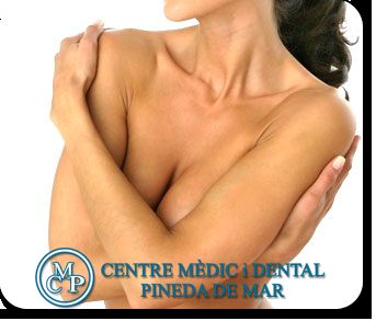 REDUCCIÓN DE PECHO: Tratamientos de Clínica Cerdanyola del Vallès REDUCCIÓN DE PECHO: Tratamientos de Clínica Cerdanyola del Vallès