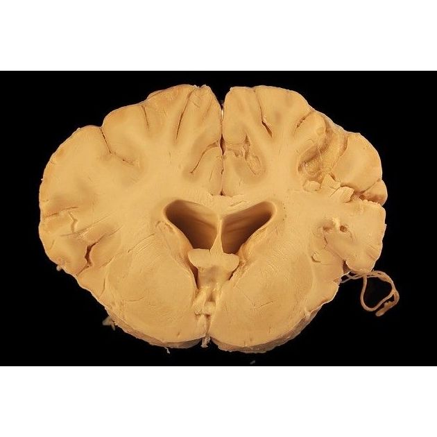 Distintos problemas neurológicos: Especialidades de Neurología de Lainez Andrés, J.M Distintos problemas neurológicos: Especialidades de Neurología de Lainez Andrés, J.M