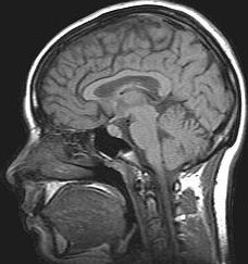 Electroencefalograma (EEG): Especialidades de Neurología de Lainez Andrés, J.M Electroencefalograma (EEG): Especialidades de Neurología de Lainez Andrés, J.M