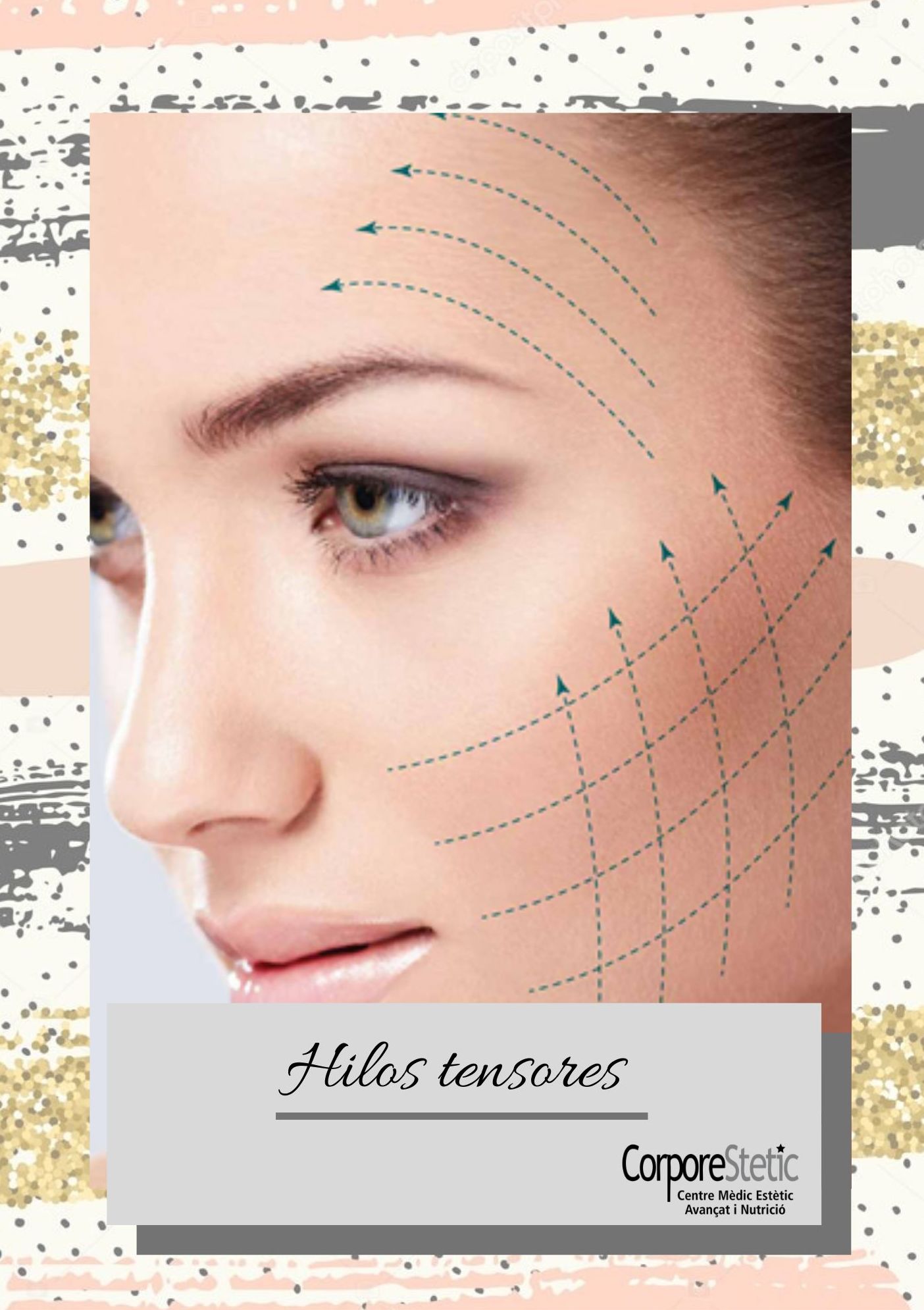 Hilos tensores: Tratamientos de Corporestetic Hilos tensores: Tratamientos de Corporestetic