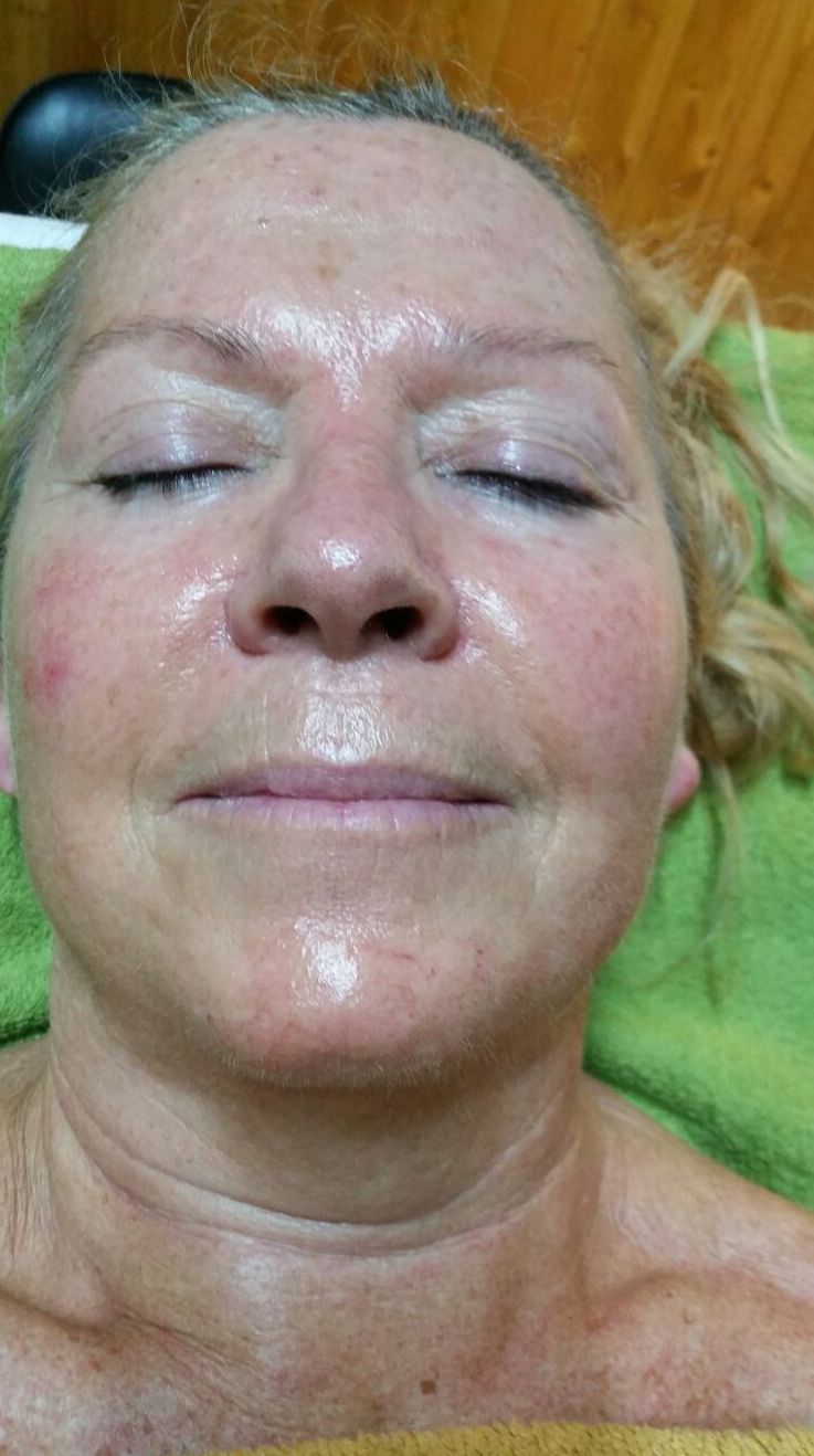 LPG Facial: Peluquería y estética de Belleza Integral 10 LPG Facial: Peluquería y estética de Belleza Integral 10