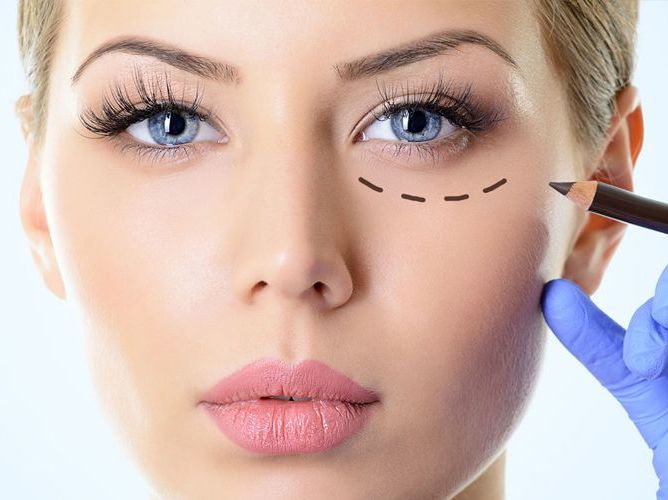 Blefaroplastia: Nuestros servicios de Carpe Diem Clínicas Blefaroplastia: Nuestros servicios de Carpe Diem Clínicas