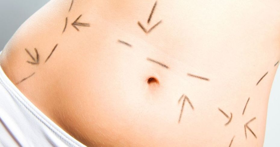 Liposucción: Nuestros servicios de Carpe Diem Clínicas Liposucción: Nuestros servicios de Carpe Diem Clínicas