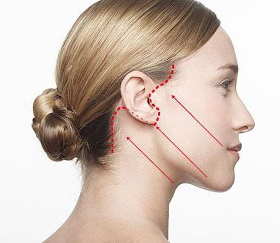 Lifting Facial: Nuestros servicios de Carpe Diem Clínicas Lifting Facial: Nuestros servicios de Carpe Diem Clínicas